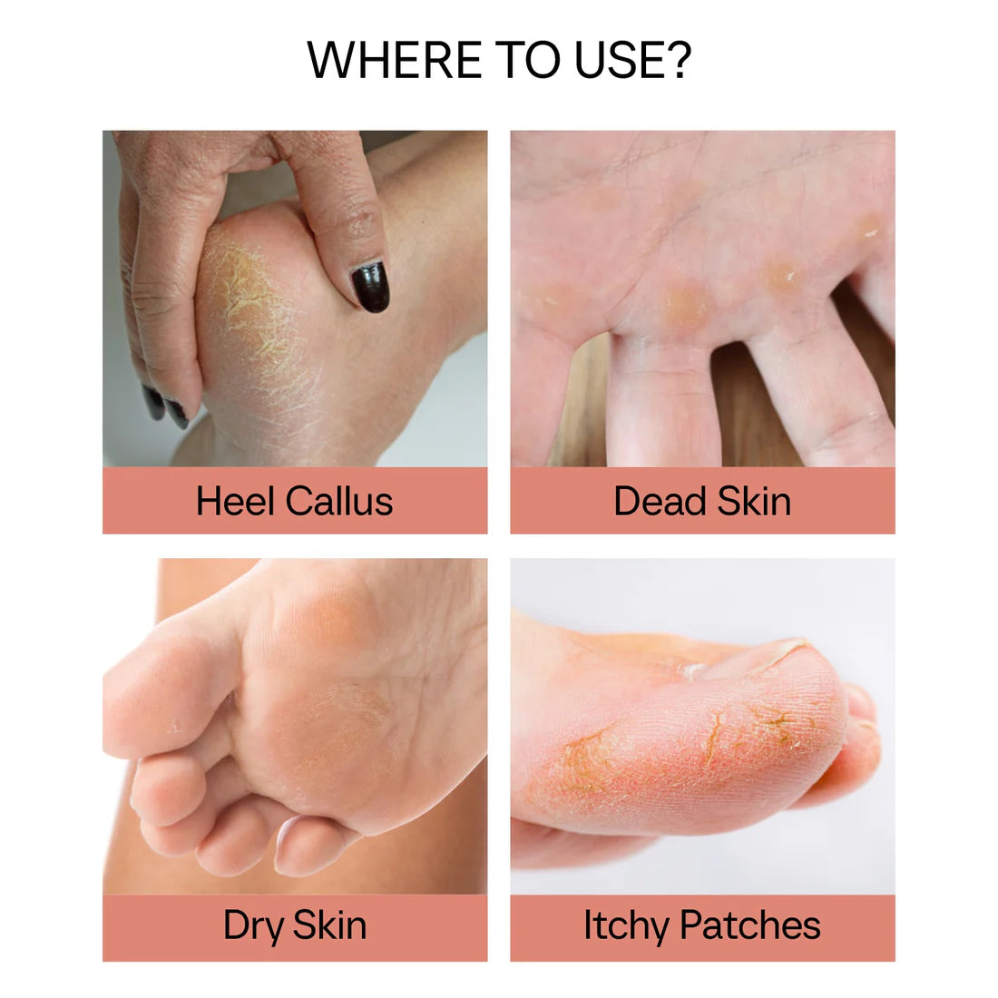 Electronic Cordless Pedicure Callus Dead Skin Remover Polishing Tool
