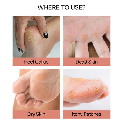 Electronic Cordless Pedicure Callus Dead Skin Remover Polishing Tool