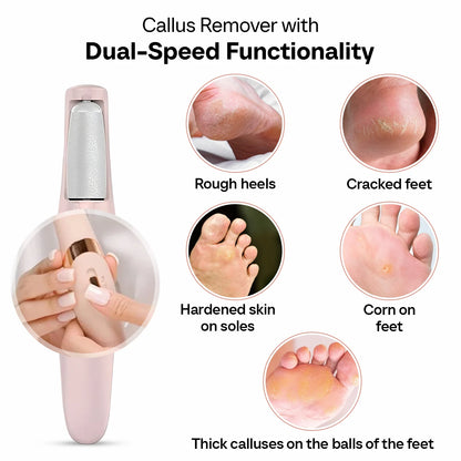 Electronic Cordless Pedicure Callus Dead Skin Remover Polishing Tool